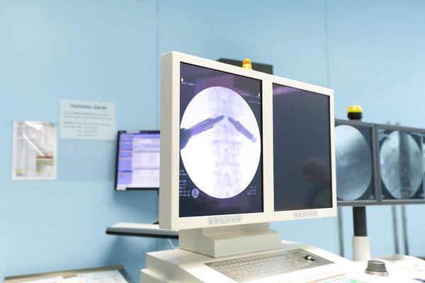 Monitor mit Röntgenbild einer Wirbelsäule