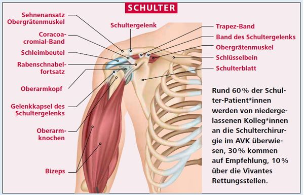 Schulter: Welche Schmerzen, Verletzungen und Erkrankungen gibt es?: Die Grafik zeigt die rechte Hälfte eines Oberkörpers ab Halsansatz bis Bauchnabelhöhe, in dem Knochen, Muskeln und das Schultergelenk eingezeichnet sind. Linien führen zu je einem Begriff, zum Beispiel Bizeps, Schleimbeutel und Schlüsselbein, und kennzeichnen das jeweilige Körperteil. Auf der rechten Seite ist in den unteren zwei Dritteln zu lesen: Rund 60 % der Schulter-Patient*innen werden von niedergelassenen Kolleg*innen an die Schulterchirurgie im AVK überwiesen, 30 % kommen auf Empfehlung, 10 % über die Vivantes Rettungsstellen.