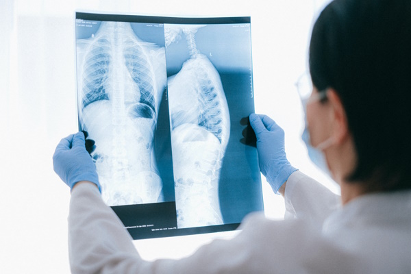 Ärztin hält Röntgenbild gegen Licht und schaut sich Aufnahme vom Skelett an